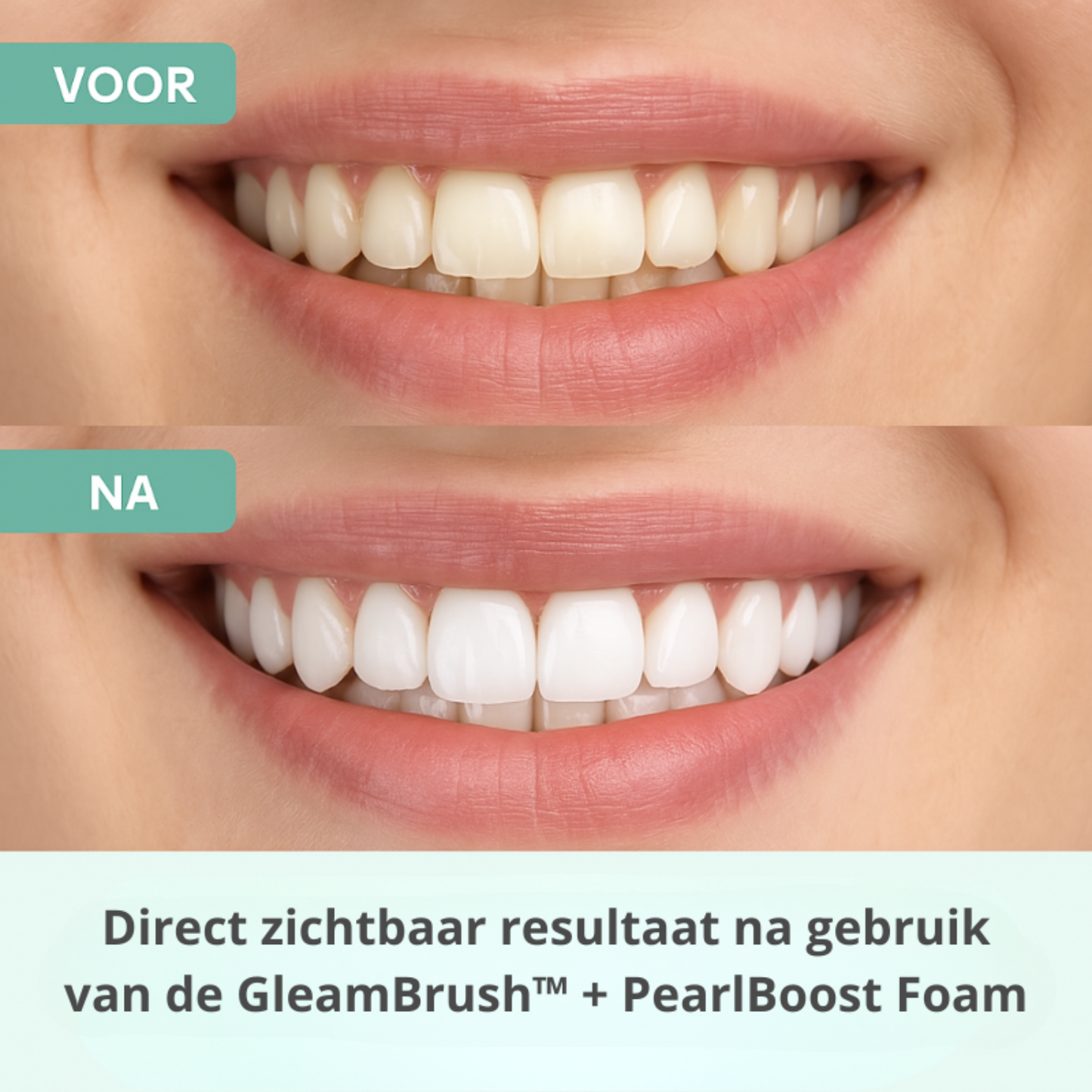 GleamSmile™ - GleamBrush
