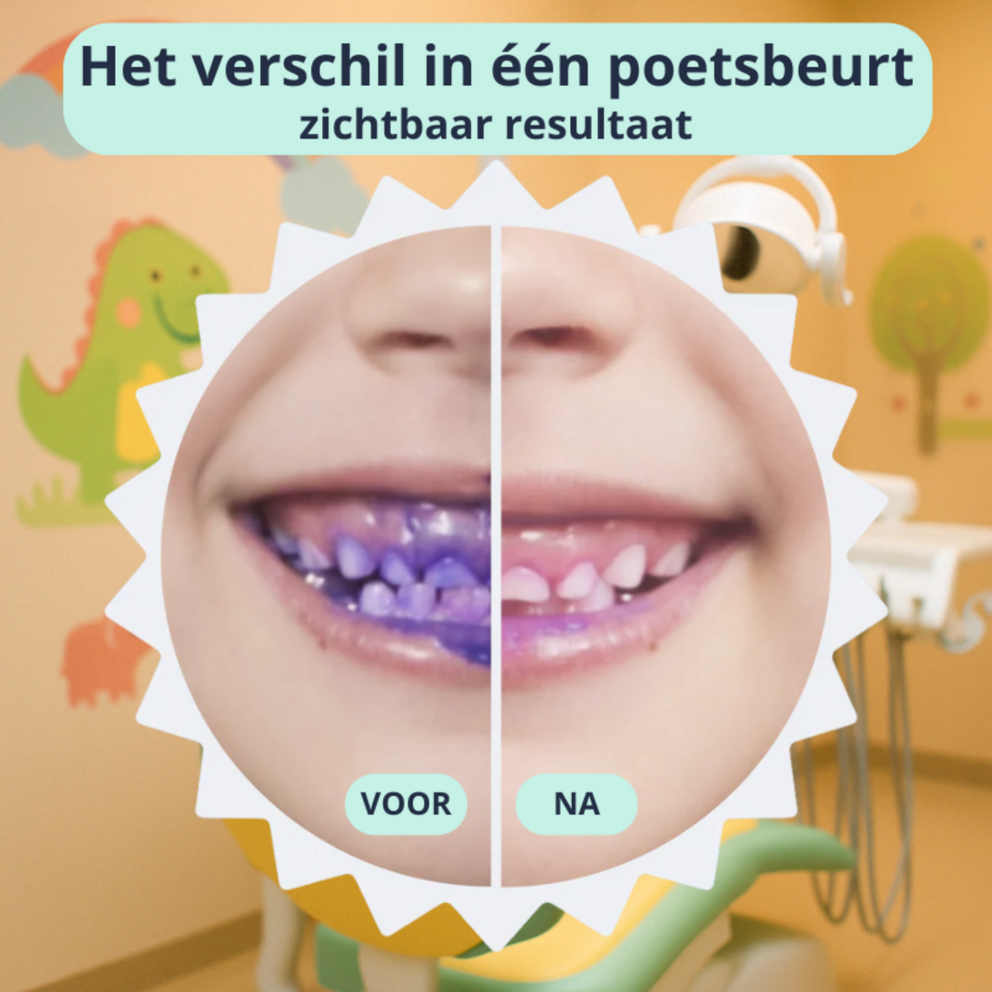 GleamSmile™ - GleamBrush | Kids bundel